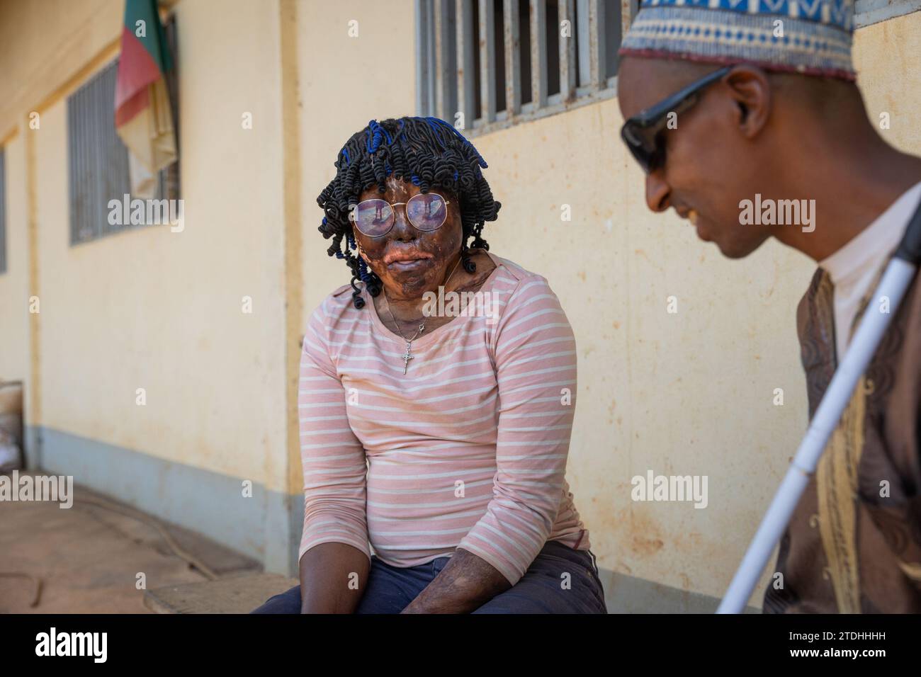 Primo piano di una giovane faccia ha bruciato una ragazza africana seduta, ascoltando il suo amico maschio cieco. Foto Stock