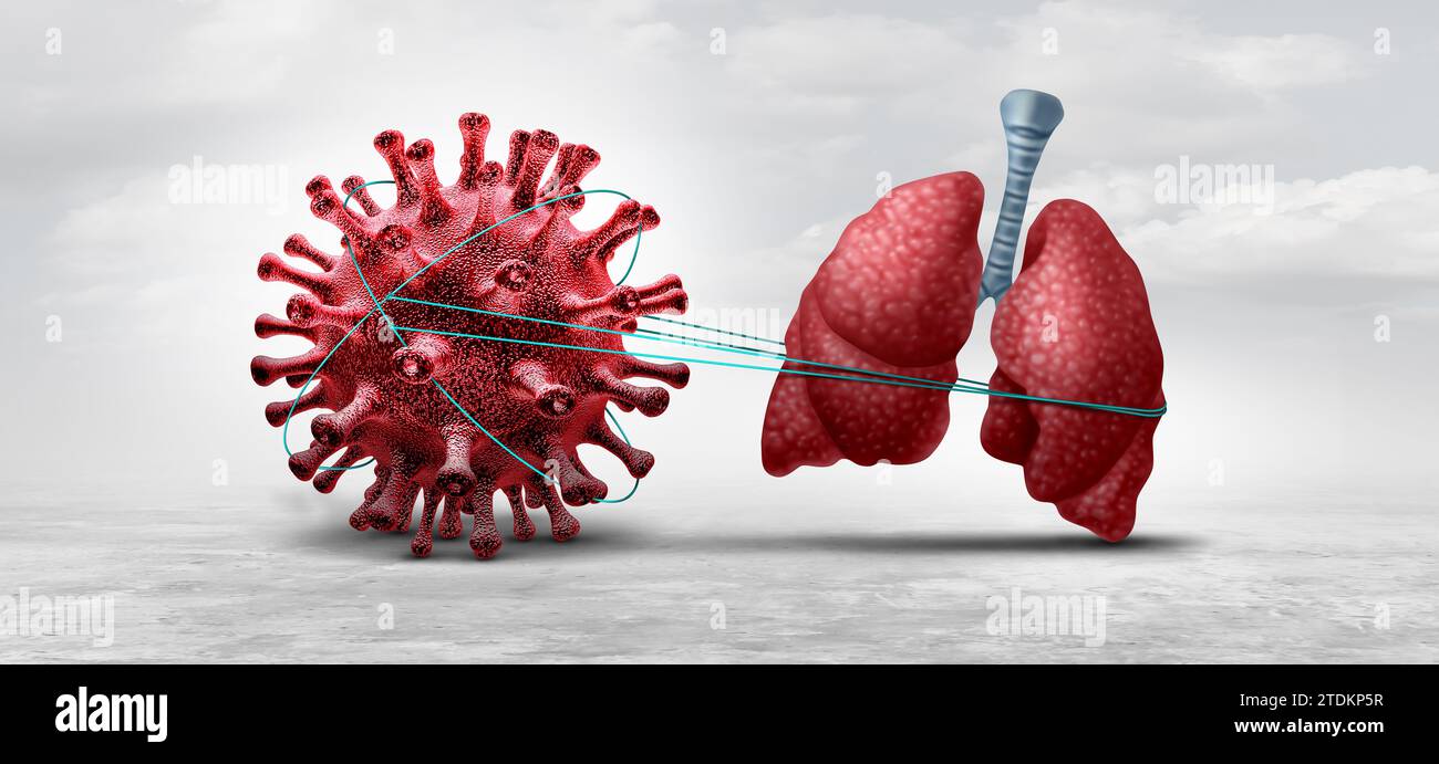 Concetto di disese respiratorio e infezione da virus polmonare come malattia virale che causa danni polmonari e difficoltà respiratorie come simbolo sanitario. Foto Stock