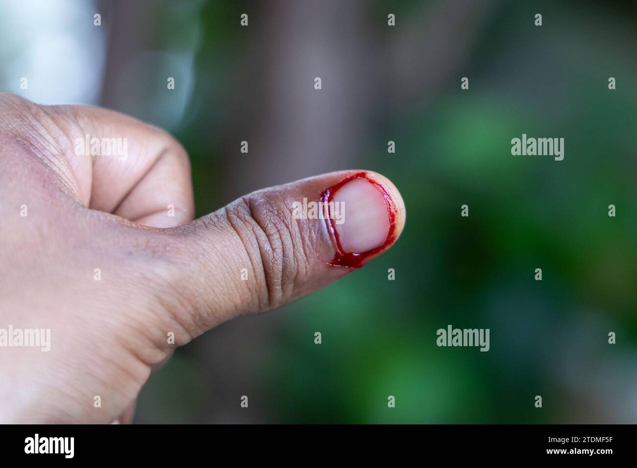 Tagliare la ferita al pollice con il sangue sul dito della mano e lo sfondo sfocato Foto Stock