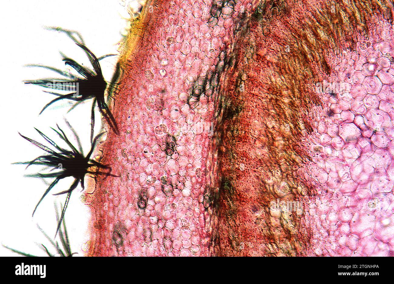 Tricomi sulla sezione epidermica della pianta di Elaeagnus. Fotomicrografia. Foto Stock