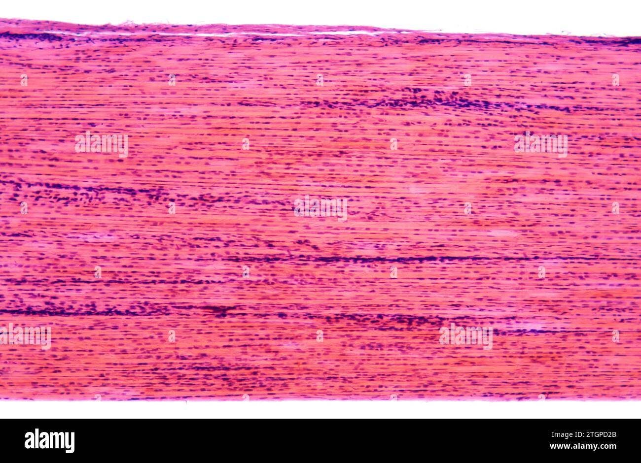 Tessuto connettivo denso che mostra fibre di collagene e fibroblasti. Fotomicrografia. Foto Stock