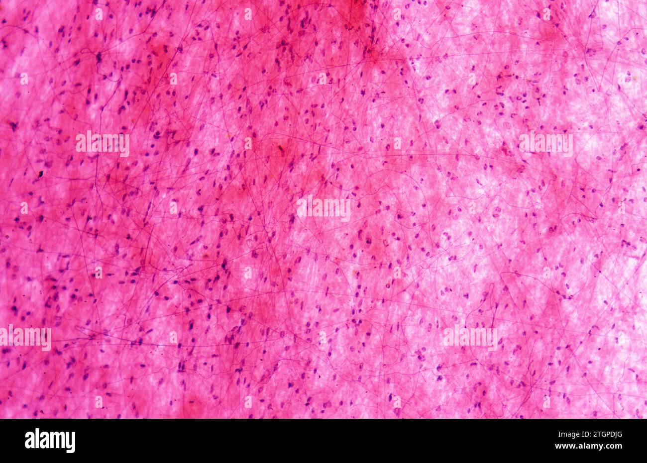Tessuto connettivo sciolto che mostra fibre di collagene e fibroblasti. Fotomicrografia. Foto Stock