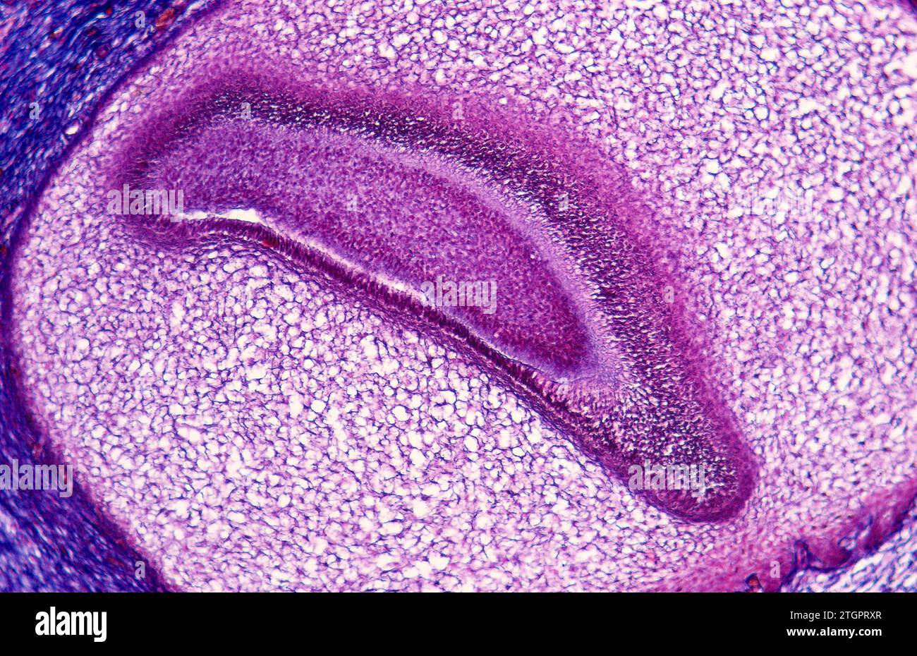 Tessuto osseo sul dente embrionale umano. Fotomicrografia. Foto Stock