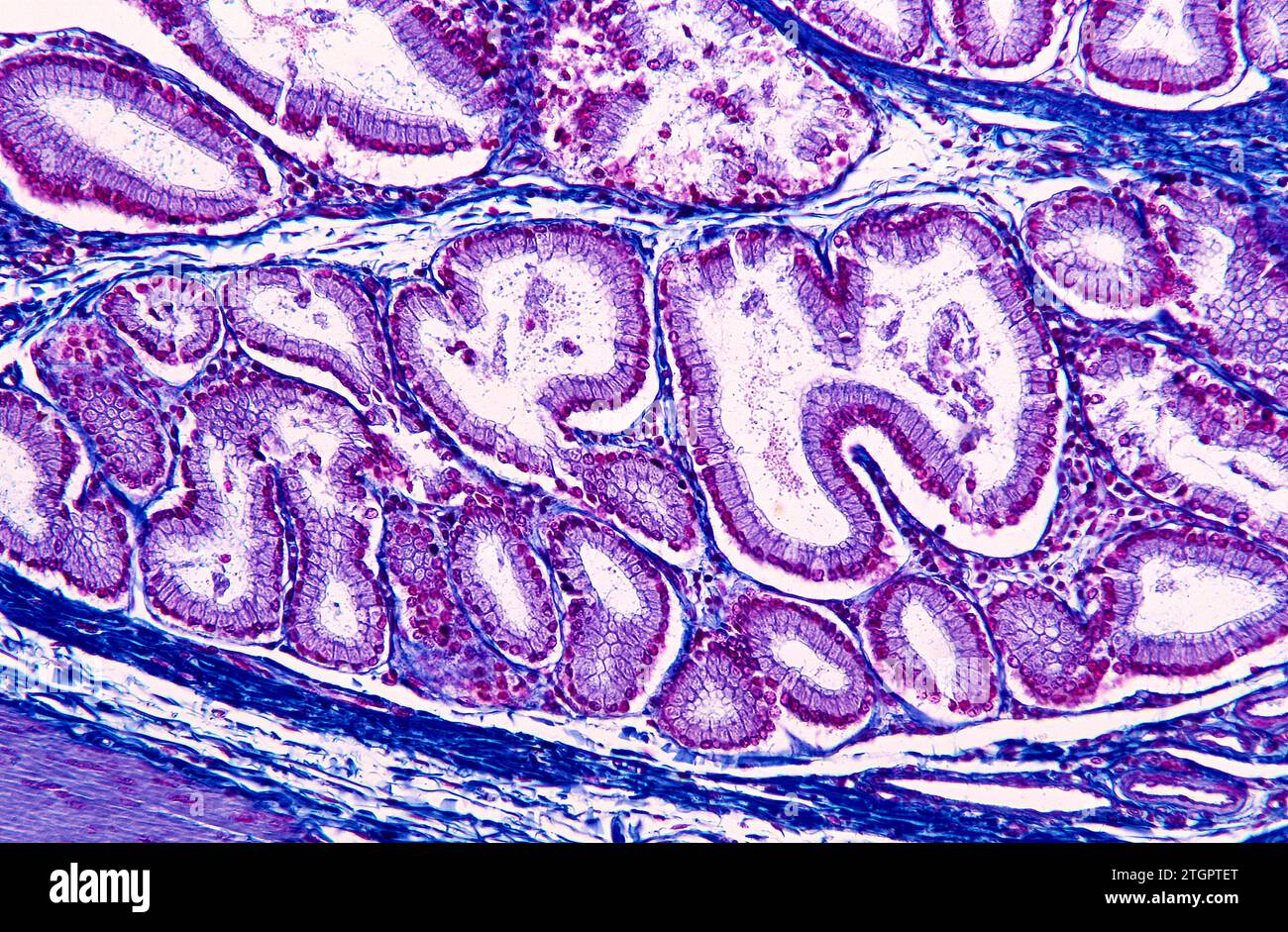 Sezione della ghiandola salivare che mostra lobuli e acini. Fotomicrografia. Foto Stock