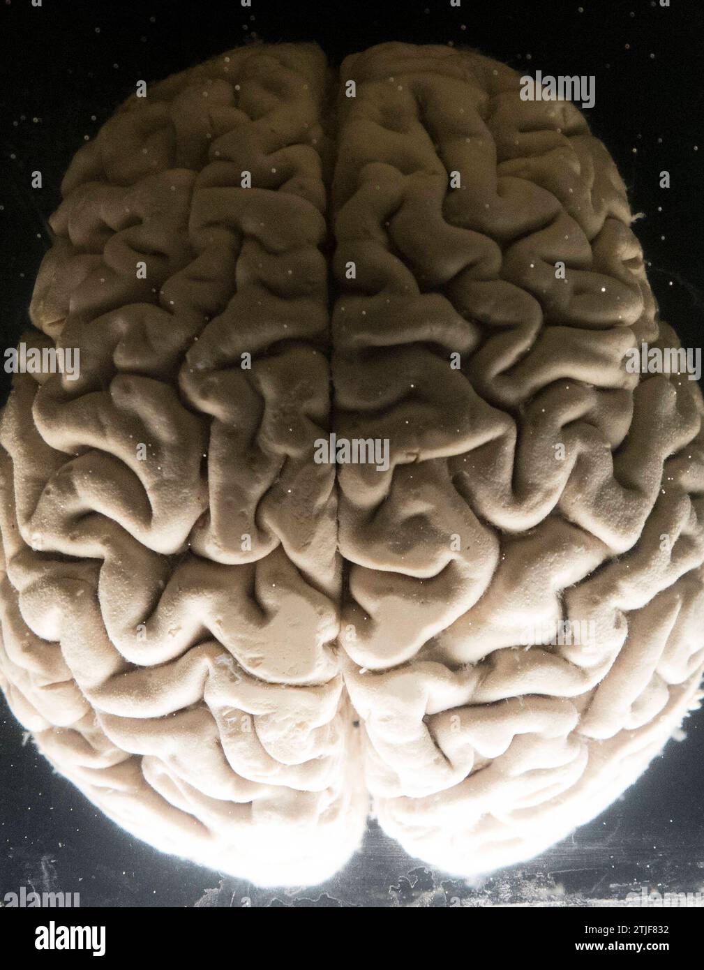 il cervello umano, l'organo più complesso del nostro corpo, il cervello umano, l'organo più complesso Foto Stock