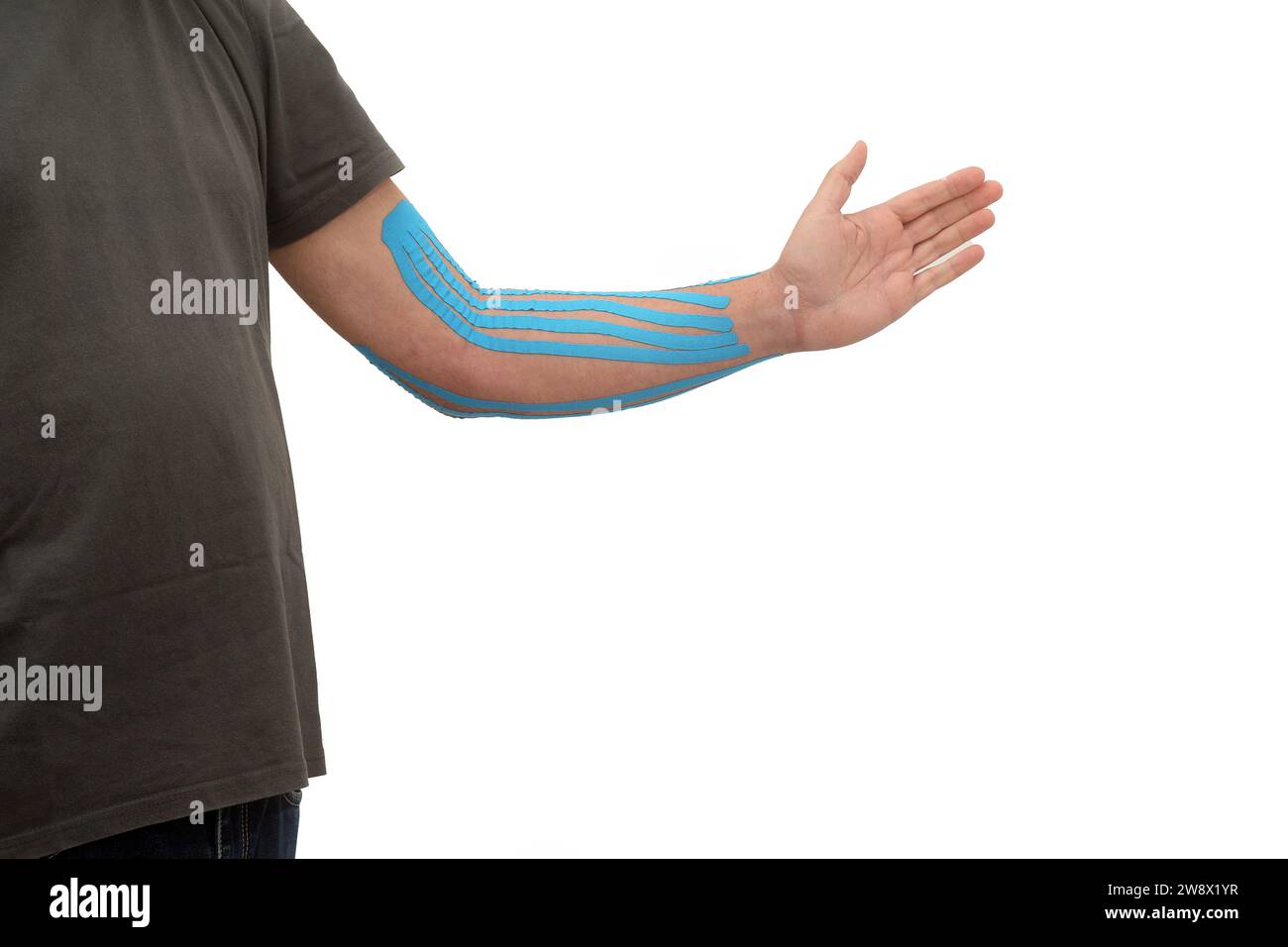 Frattura del gomito con nastro adesivo applicato al braccio di un uomo Foto Stock