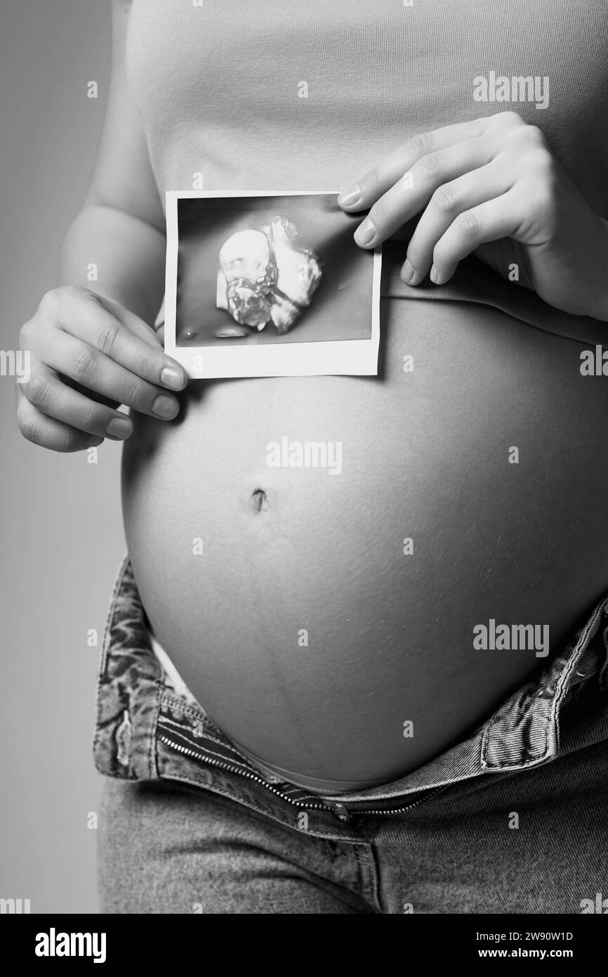 Foto in bianco e nero di una donna incinta con ecografia nelle mani vicino alla pancia. La femmina sta tenendo l'immagine dell'embrione del bambino su un pancino incinta. Foto Stock