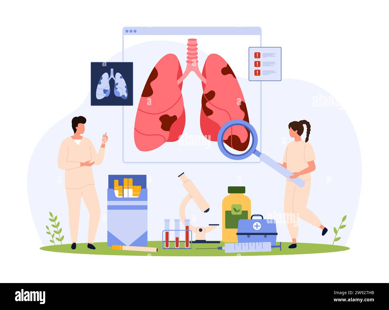 Diagnosi di malattie respiratorie e danni polmonari dovuti al fumo di sigaretta. Le persone piccole con lente di ingrandimento controllano i polmoni del fumatore sulla carta anatomica medica nell'illustrazione vettoriale del cartone animato dell'ospedale Illustrazione Vettoriale