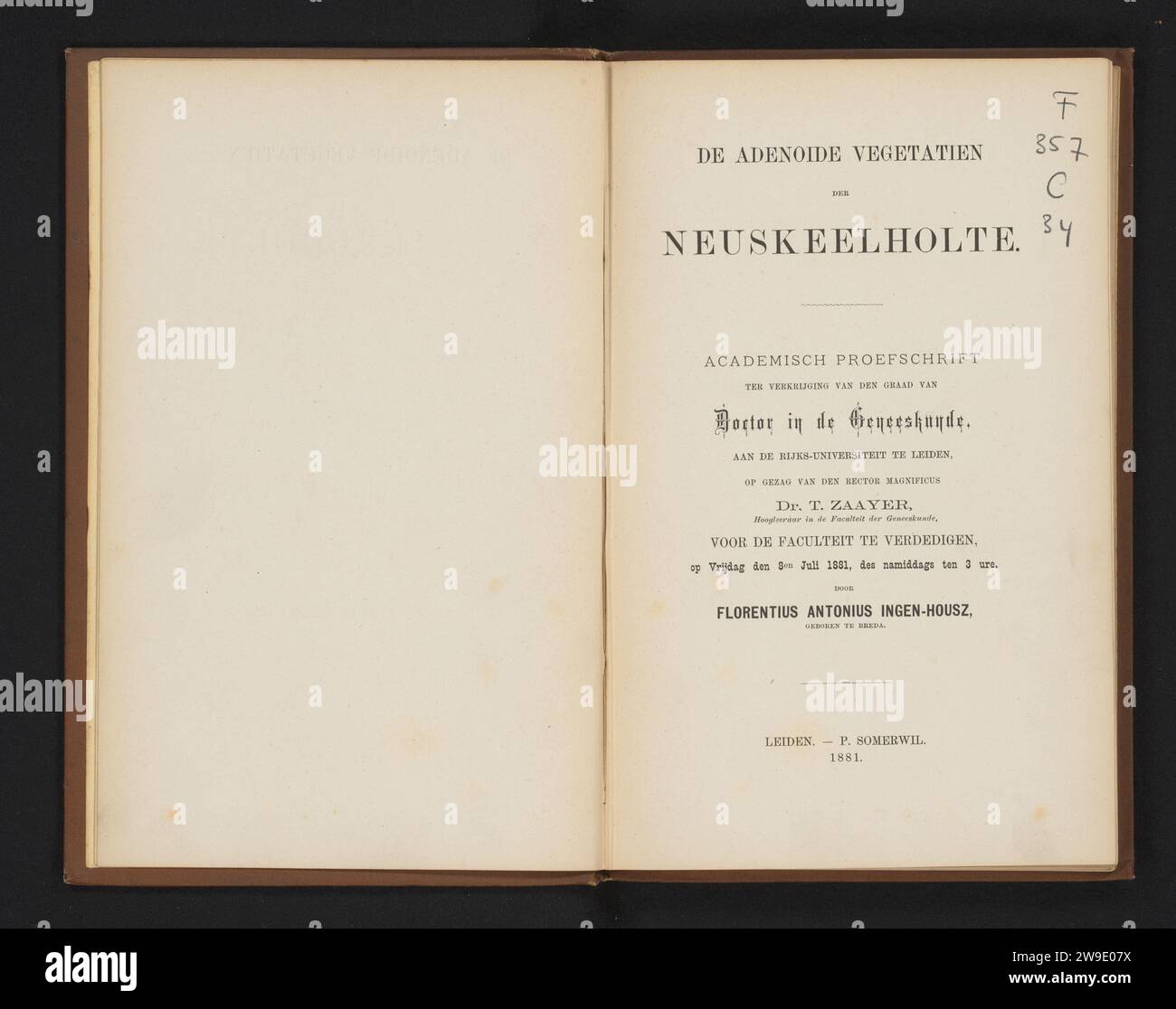 The Adenosive Vegetaties of Nasal Chart, 1881 libro. supporto fotografico. cartone. stampa/stampa di albumi di lino (materiale) Foto Stock