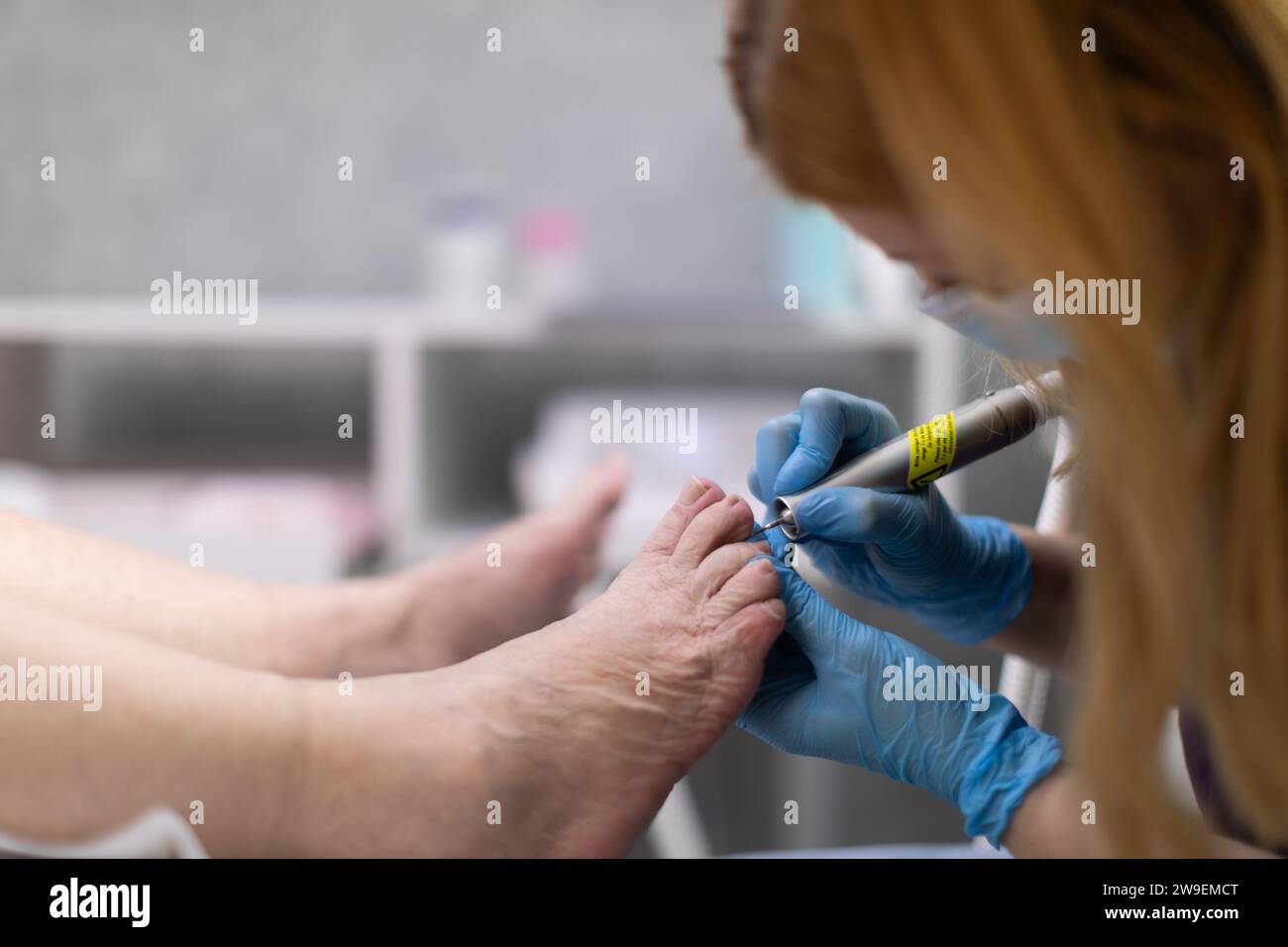 Primo piano dei piedi di una donna che è venuta per un appuntamento da podiatra. Foto Stock