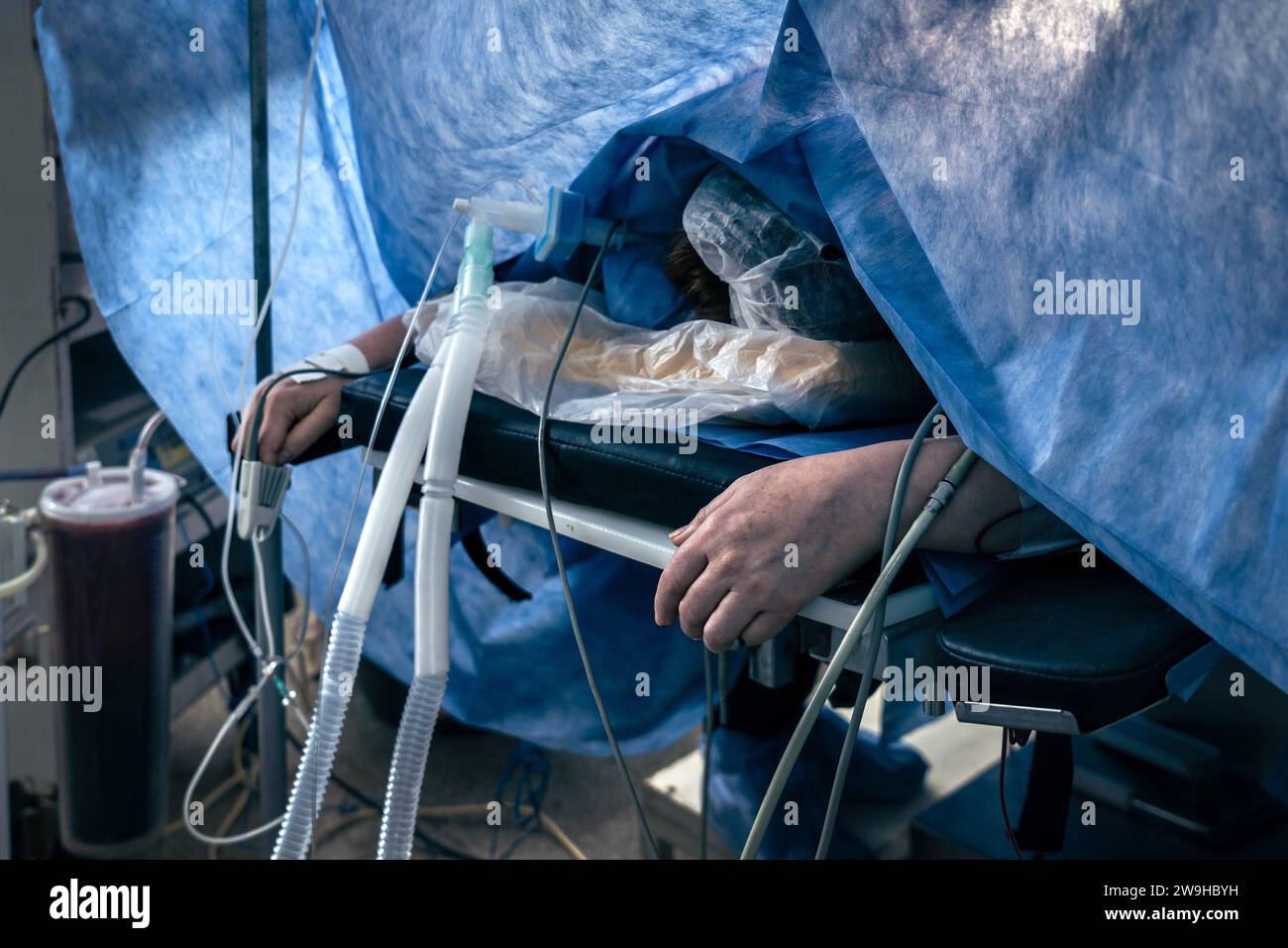 Paziente non identificato sul tavolo operatorio in anestesia generale. Foto Stock