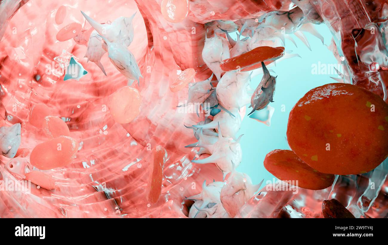 Emostasi. Globuli rossi e piastrine nel vaso sanguigno, vasocostrizione, processo di guarigione delle ferite. Embolie coagulanti emorragiche, emofilia. fibrino Foto Stock