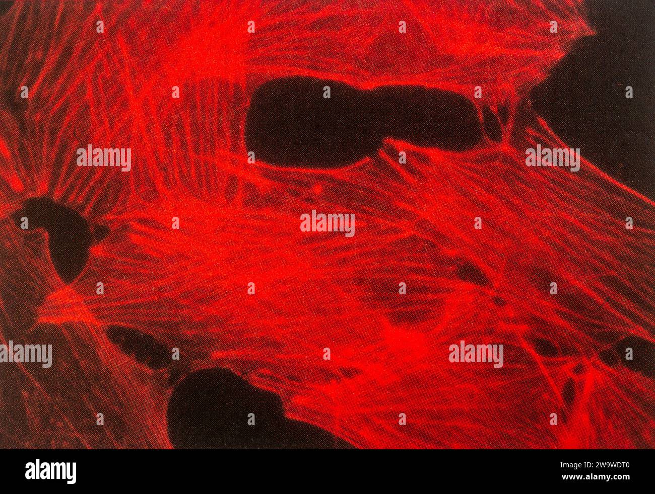 Microscopia fluorescente di cellule, in particolare fibroblasti, colorato con falloidina etichettata fluorescentemente mostrando fibre da stress actina Foto Stock