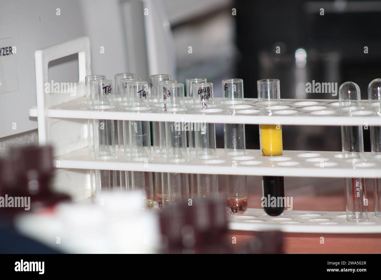 Provetta in vetro per analisi chimiche da laboratorio. India Foto Stock