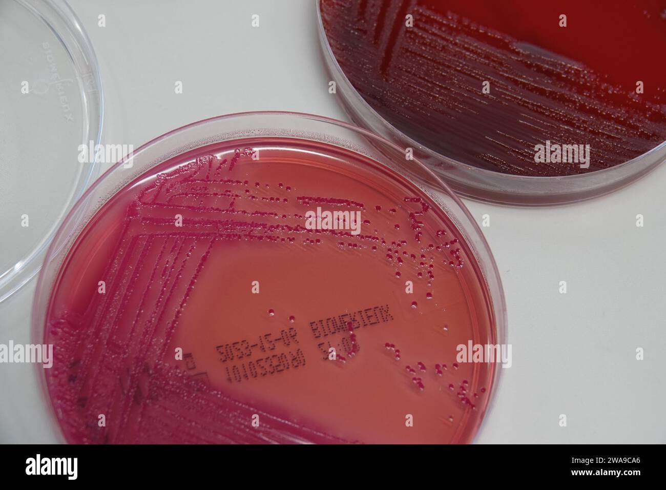 PRODUZIONE - 29 novembre 2023, Zurigo, Zürich: Una piastra Petri con batteri provenienti da un campione di feci in un terreno di coltura di colore rosso. Gli scienziati svizzeri vogliono creare una cassaforte per i batteri intestinali provenienti da tutto il mondo. (A dpa 'A vault for Human feces: Project mira a salvare i batteri intestinali') foto: Christiane Oelrich/dpa Foto Stock