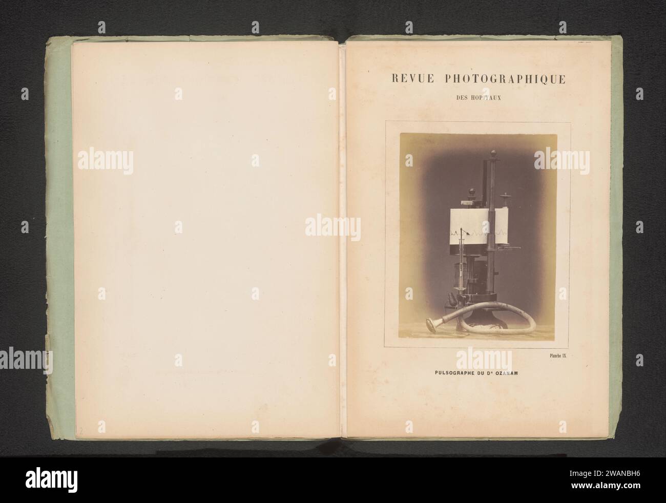 Pulsmetro, anonimo, c. 1865 - in o prima 1870 carta fotografica albumen stampa medicina, scienza medica Foto Stock