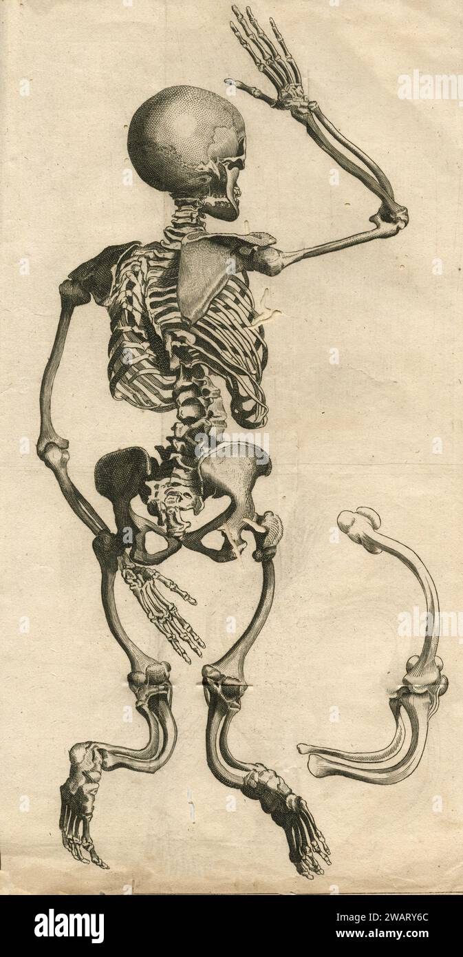 Disegno anatomico vintage: Scheletro umano deformato, Transation Philosophique, Francia anni '1700 Foto Stock