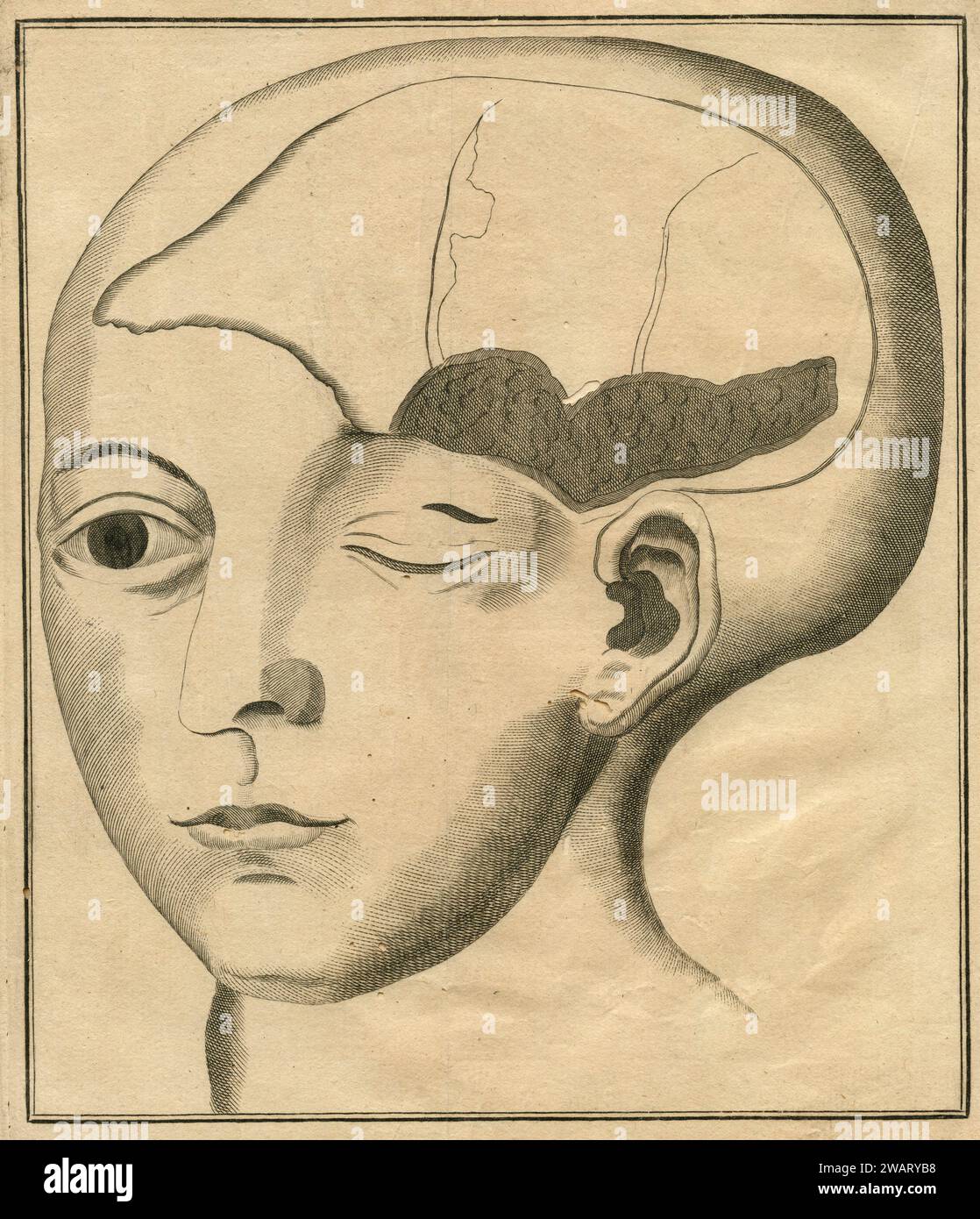 Disegno anatomico vintage: Testa umana deformata, Transation Philosophique, Francia anni '1700 Foto Stock