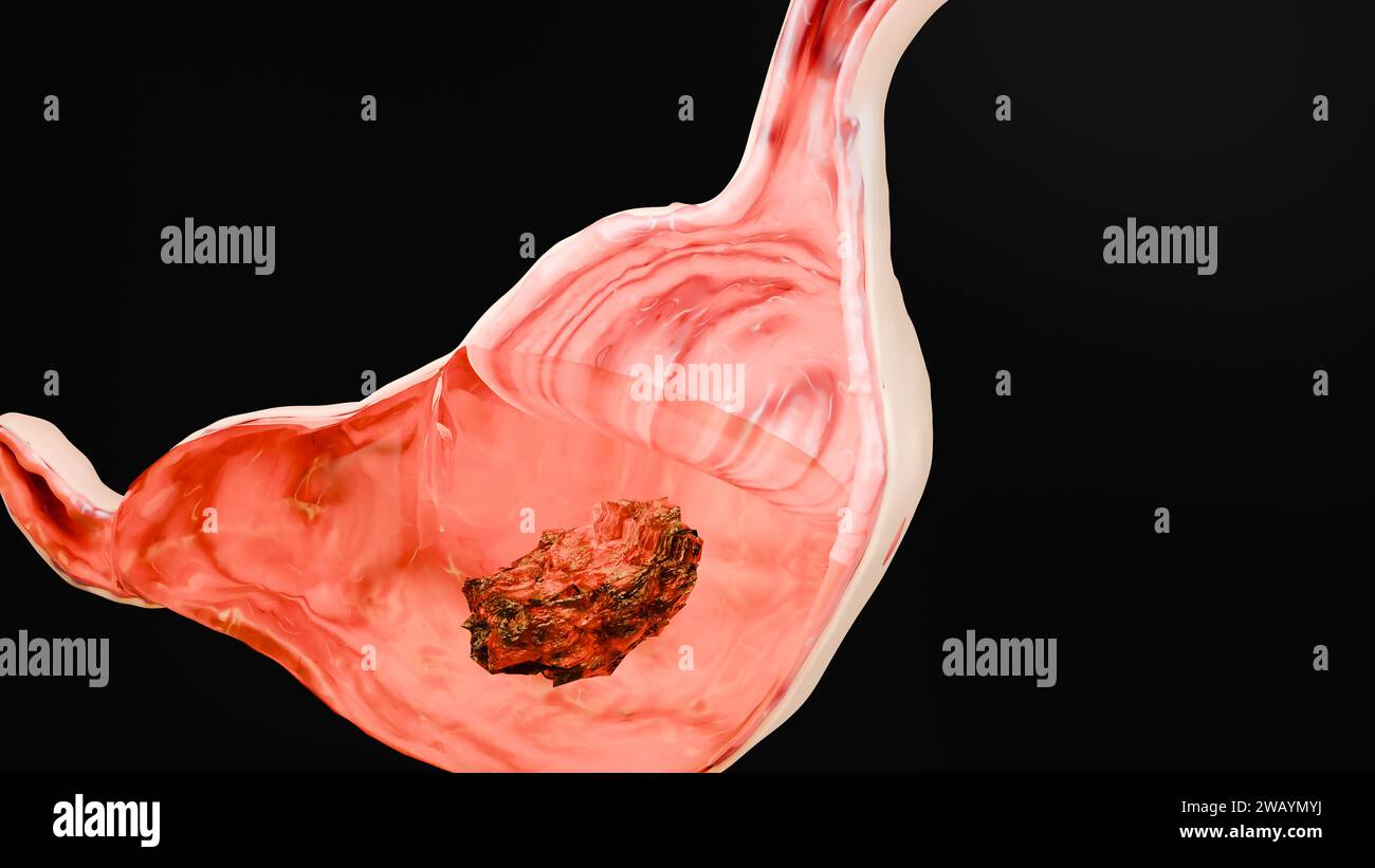Stomaco umano anatomia digestione, esofago addome gastrico con digestivo acido, sezione trasversale isolata di organo interno, intestino gastrico, processo di Foto Stock