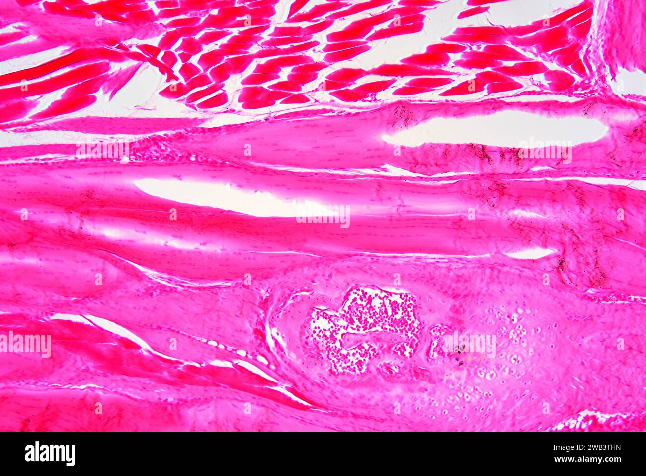 Fibroblasti umani (strutture nere fibrillari). X75 a 10 cm di larghezza. Foto Stock