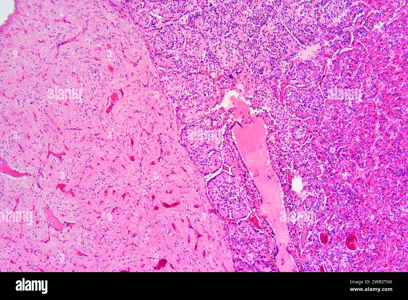 Ipofisi umana o ghiandola pituitaria. X75 a 10 cm di larghezza. Foto Stock
