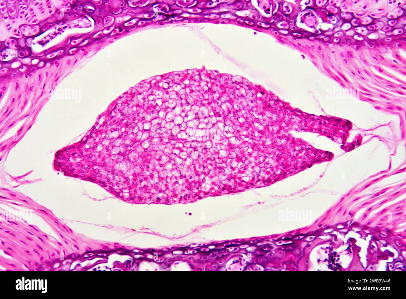 Midollo osseo giallo umano, tessuto ematopoietico. X75 a 10 cm di larghezza. Foto Stock