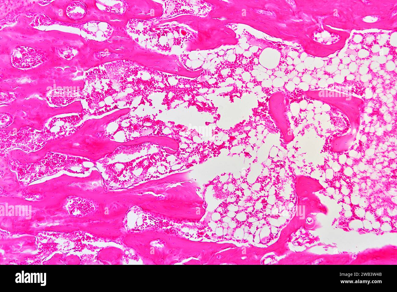 Midollo osseo rosso umano, tessuto ematopoietico. X75 a 10 cm di larghezza. Foto Stock
