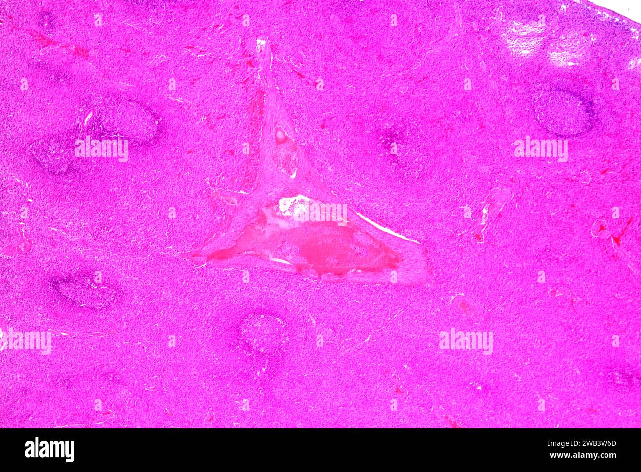 Milza umana (organo linfatico) con capsule, polpa rossa, polpa bianca e vaso sanguigno. X25 a 10 cm di larghezza. Foto Stock