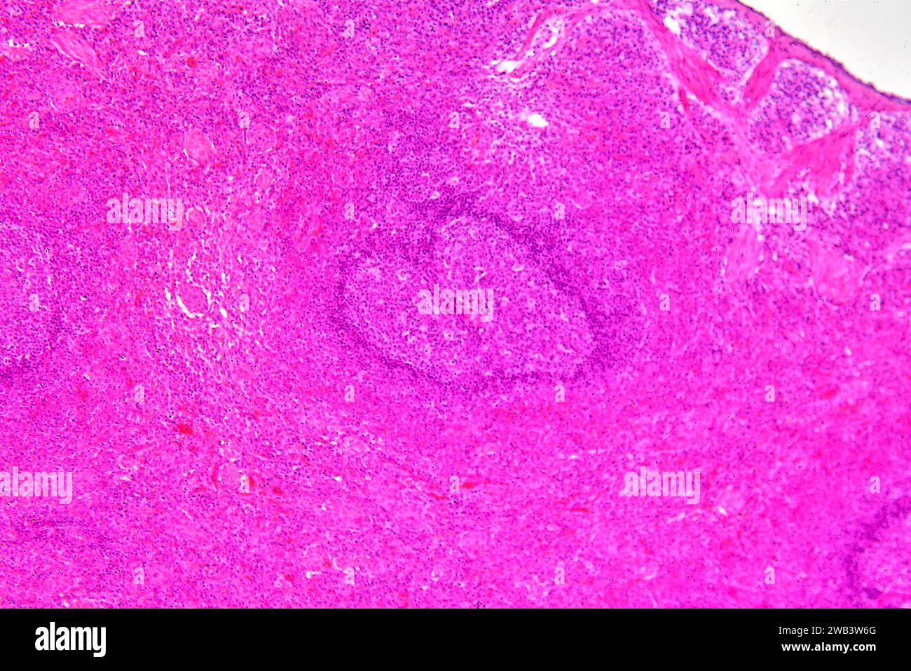 Milza umana (organo linfatico) con capsule, polpa rossa e polpa bianca. X75 a 10 cm di larghezza. Foto Stock