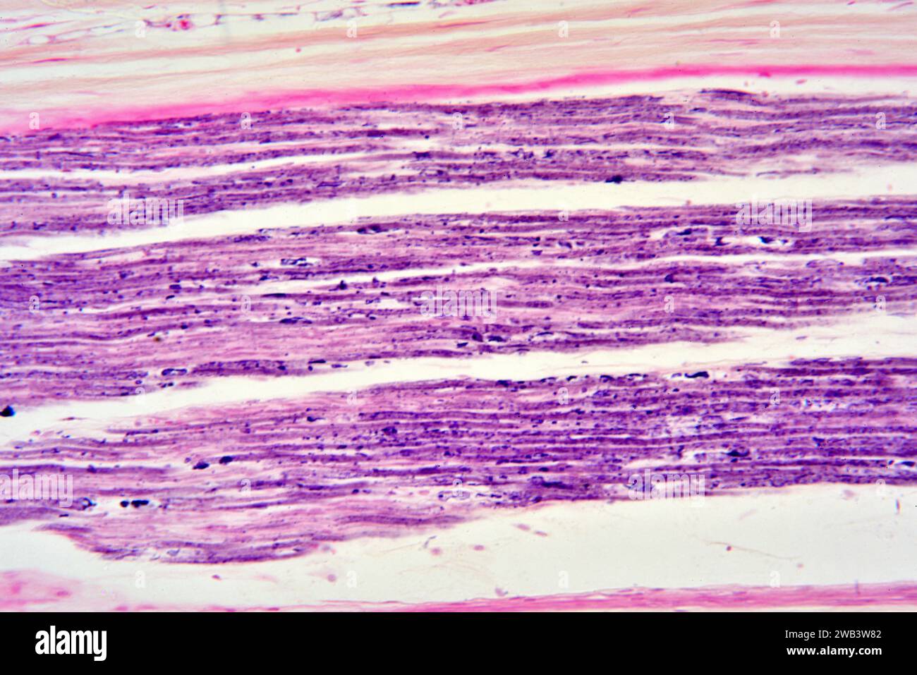Nervo sciatico umano o nervo ischiadico. X125 a 10 cm di larghezza. Foto Stock