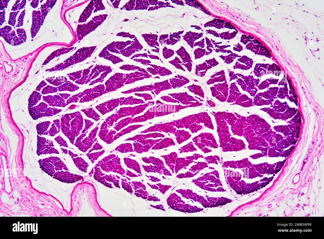 Fibre nervose umane con perineurio. X75 a 10 cm di larghezza. Foto Stock
