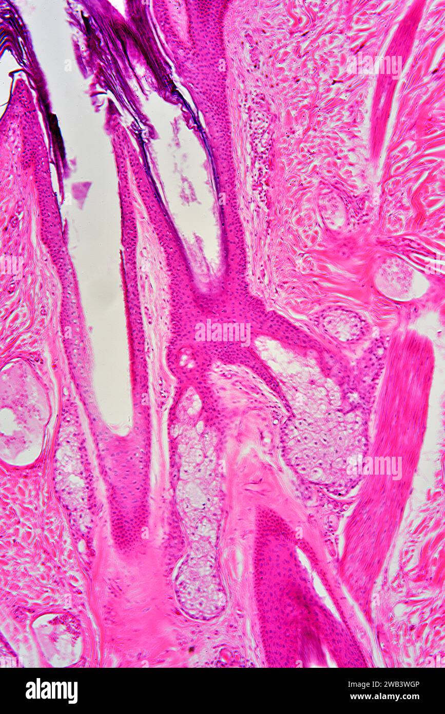 Pelle umana che mostra ghiandola sebacea e follicolo pilifero. X75 a 10 cm di altezza. Foto Stock