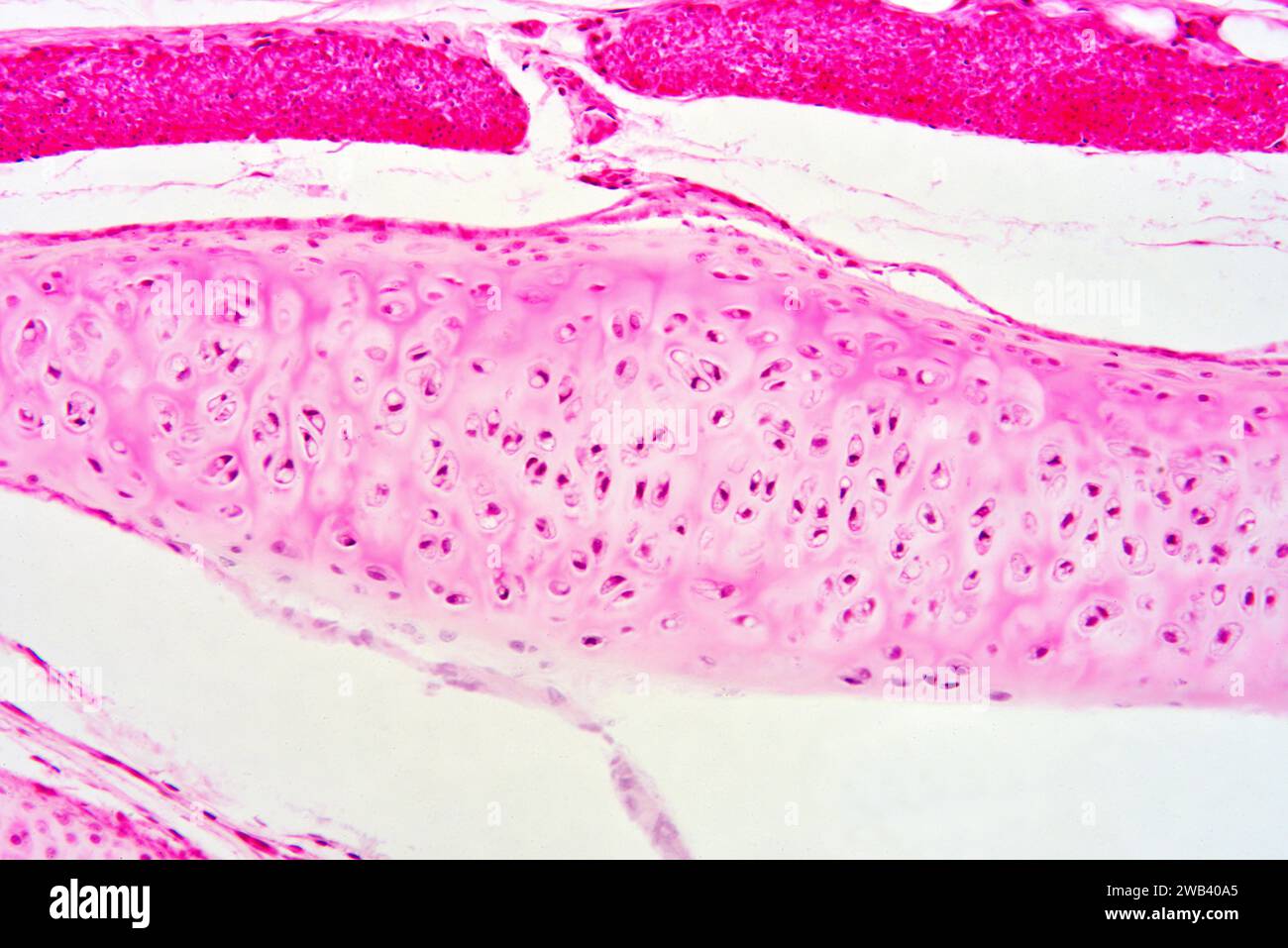 Trachea umana con cartilagine ialina. X125 a 10 cm di larghezza. Foto Stock