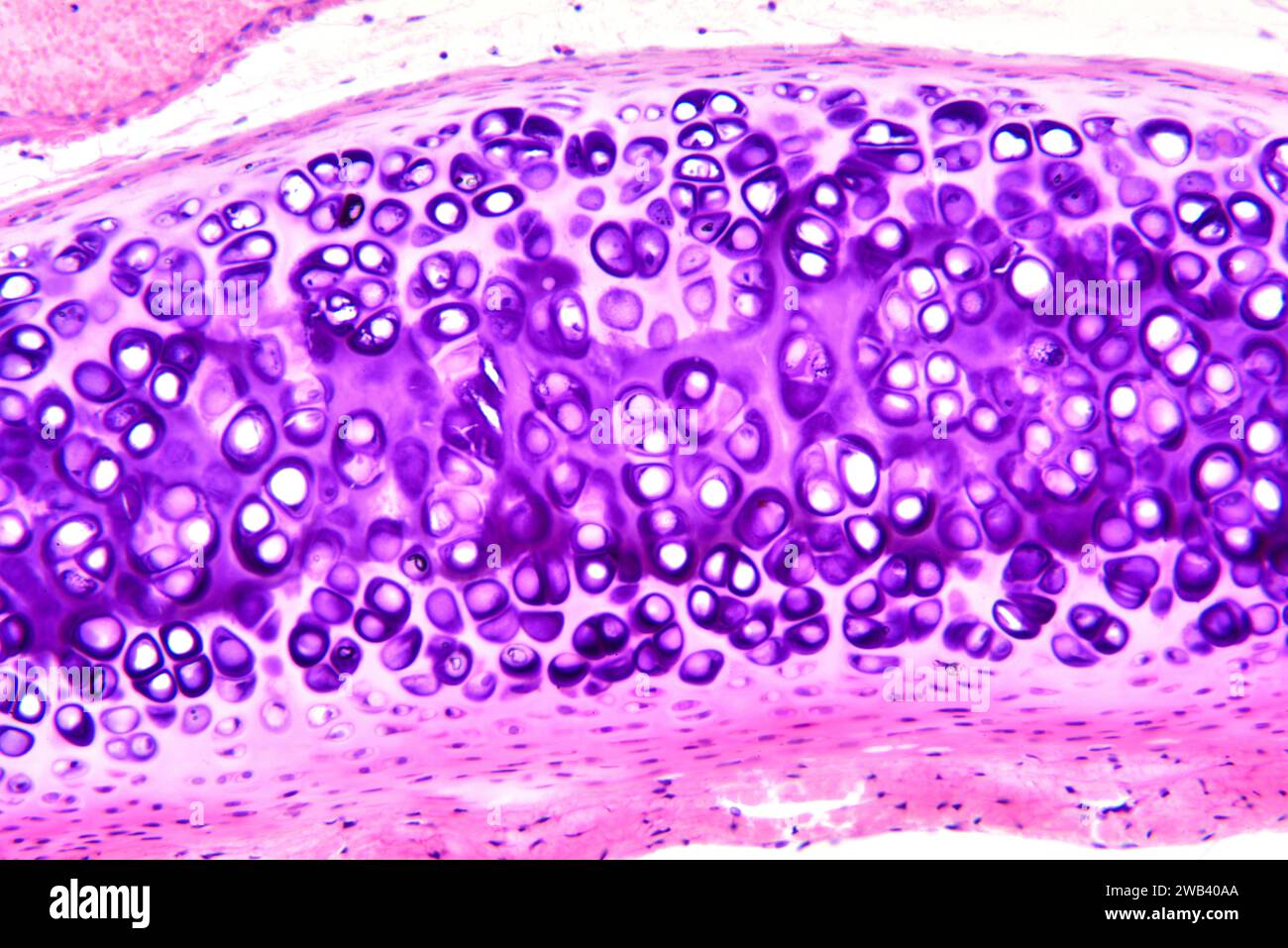 Cartilagine ialina umana. X125 a 10 cm di larghezza. Foto Stock