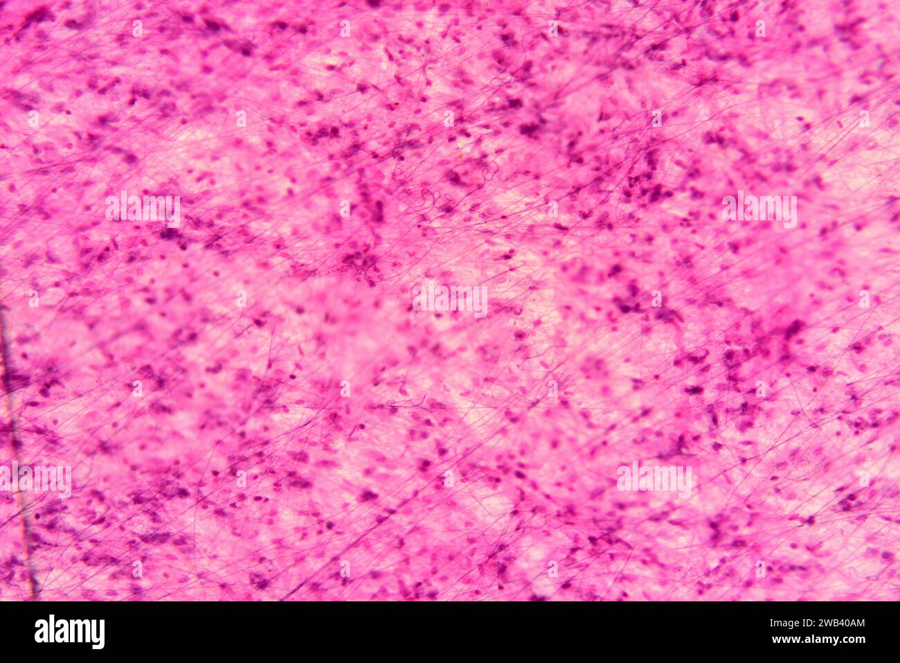 Tessuto connettivo sciolto umano con fibroblasti, fibre di collagene e matrice. X75 a 10 cm di larghezza. Foto Stock