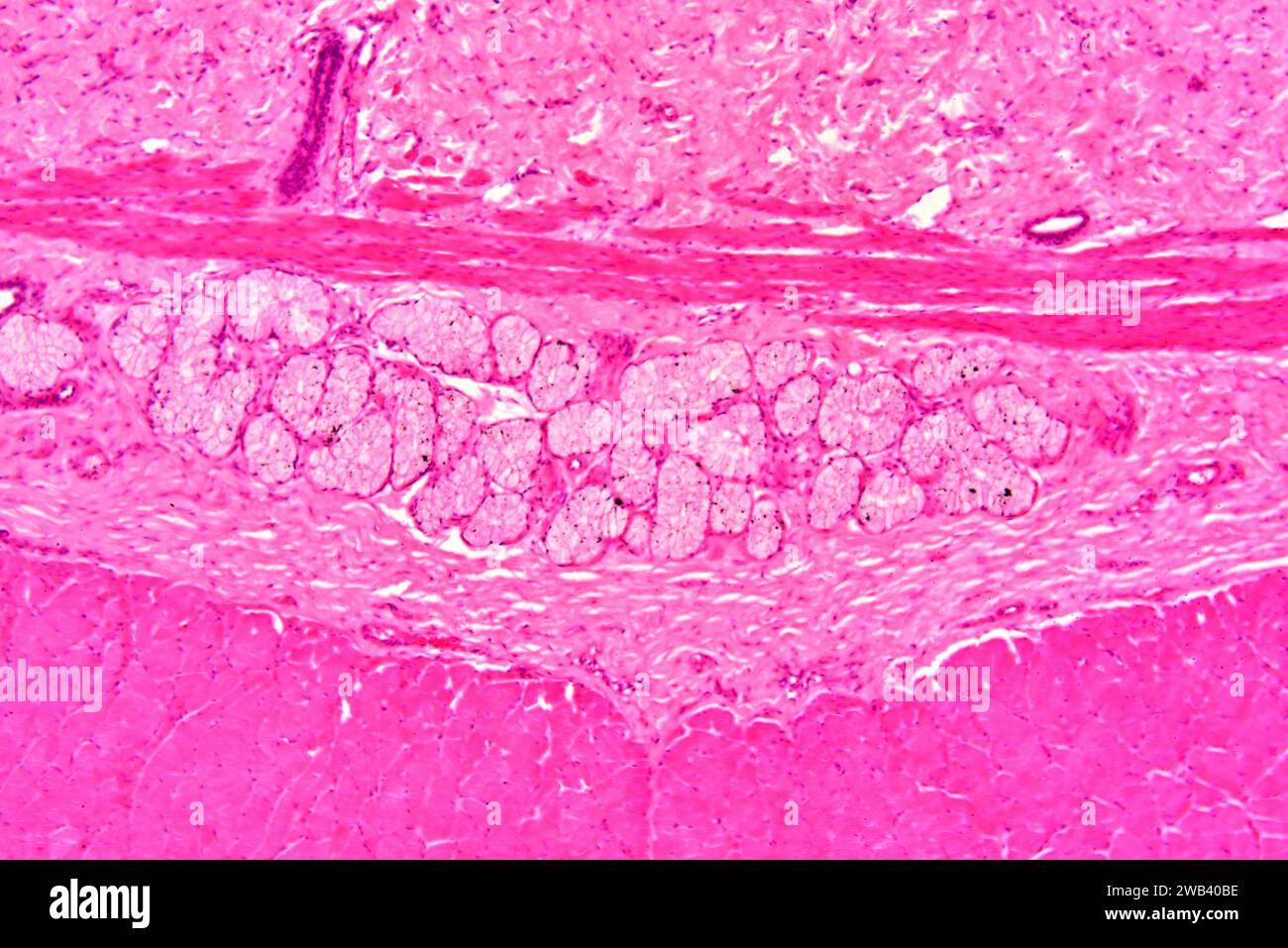 Epitelio ghiandolare umano e fibre muscolari lisce. X75 a 10 cm di larghezza. Foto Stock