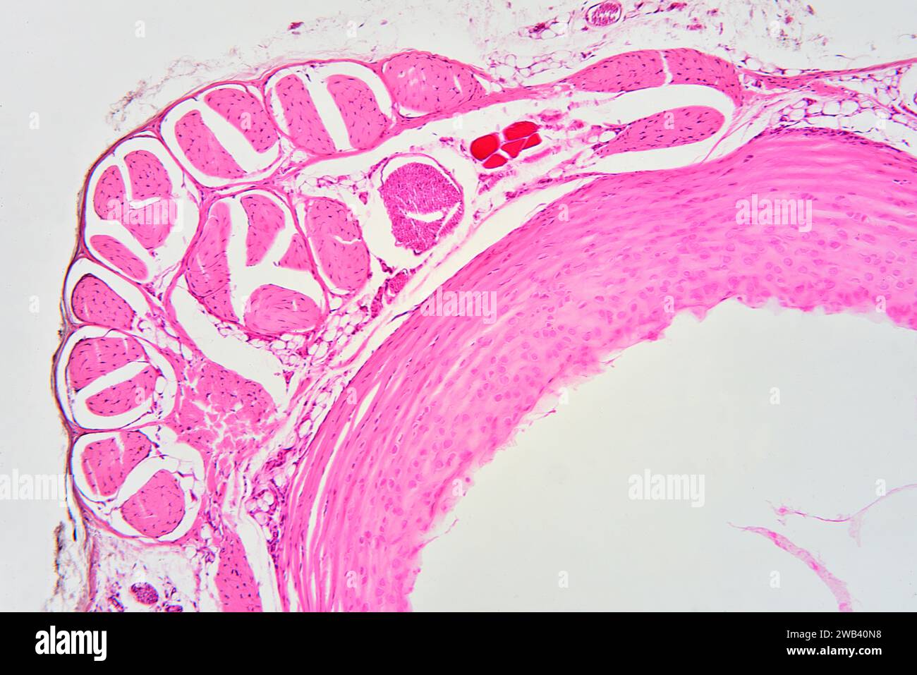 Tendine umane. Il tendine collega il muscolo all'osso. X75 a 10 cm di larghezza. Foto Stock