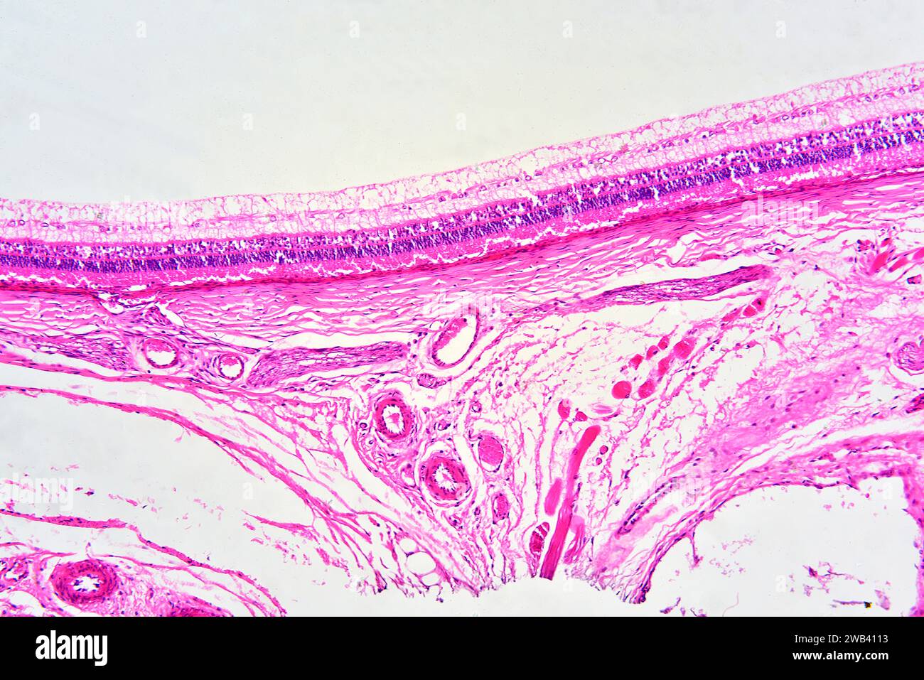 Sezione dell'occhio umano che mostra retina con aste e coni, tessuto coroide e connettivo con vasi sanguigni. X75 a 10 cm di larghezza. Foto Stock