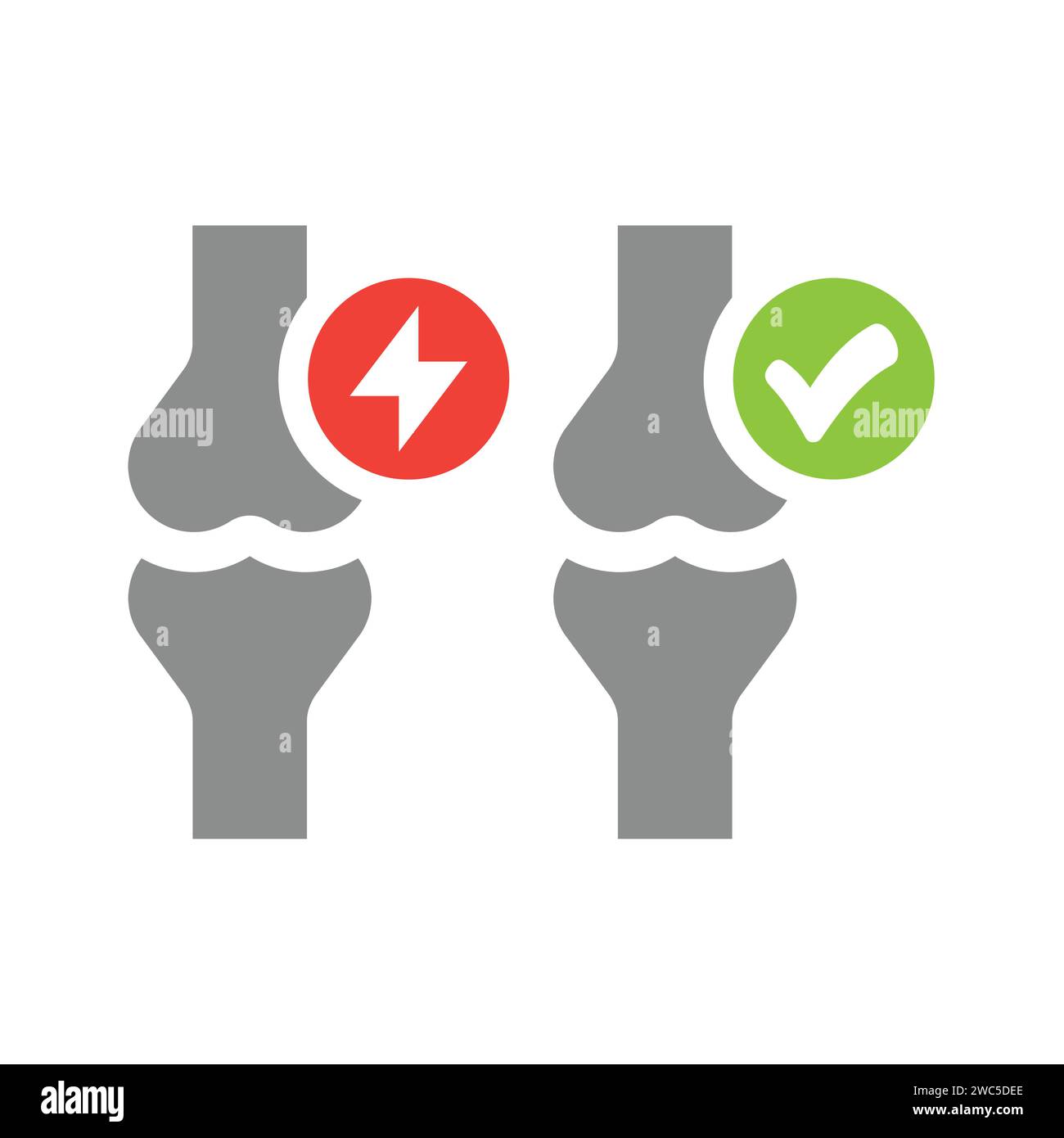 Set di icone vettoriali per le articolazioni ossee umane. Dolore articolare o artrite e sano con icone di segno di spunta. Illustrazione Vettoriale