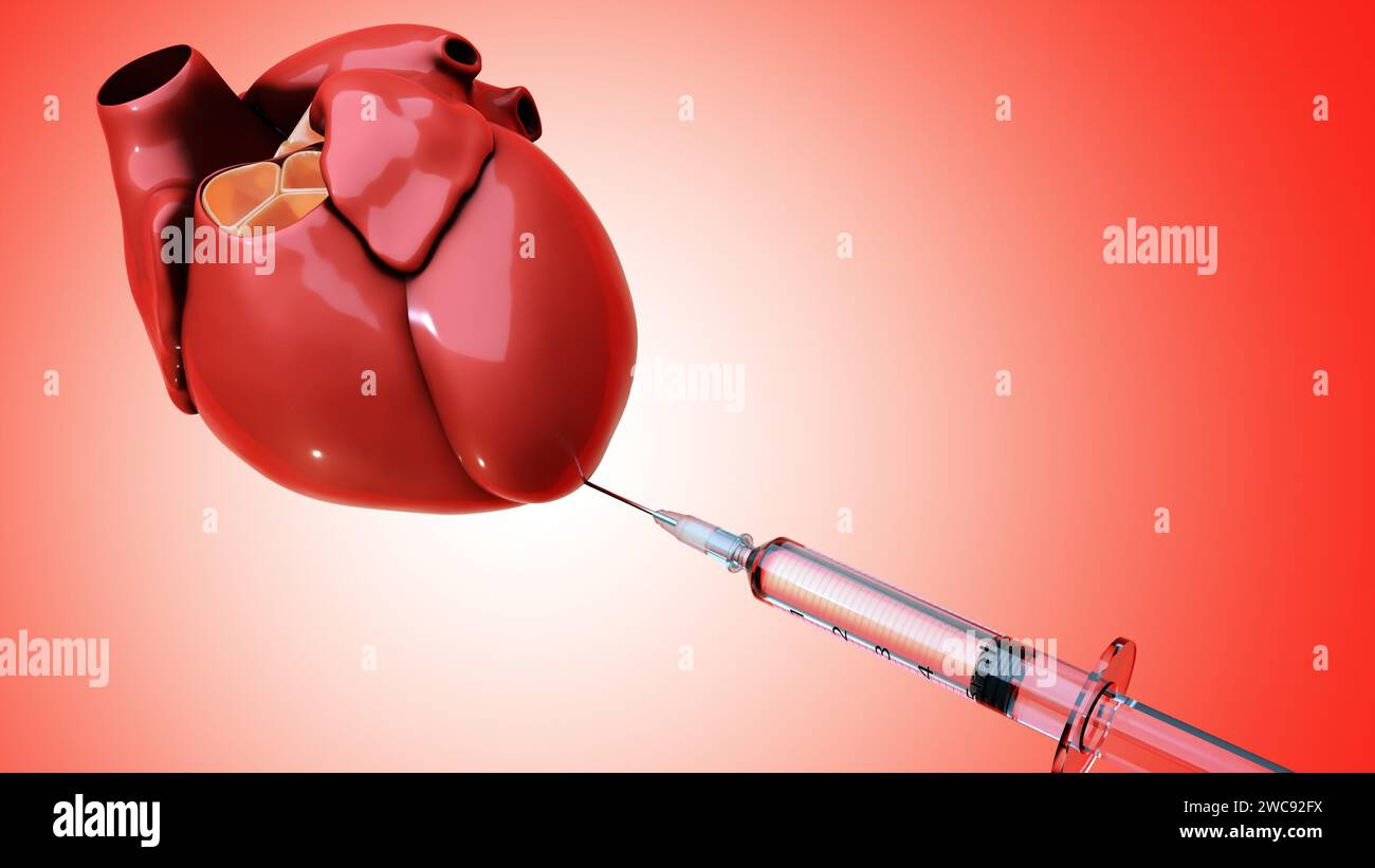 Siringa cardiaca e medica con rendering 3d o conosciuta come iniezione intracardiaca Foto Stock