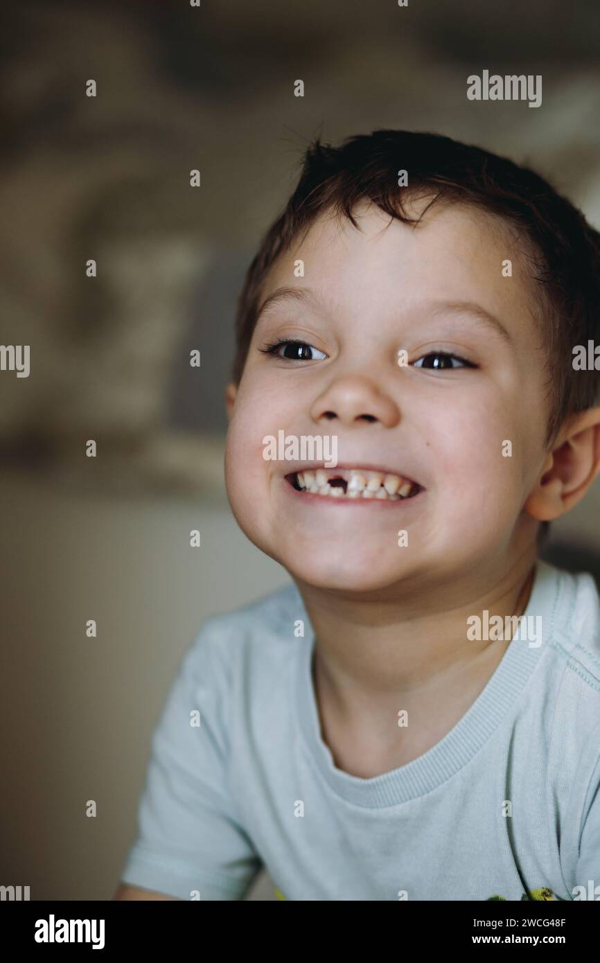 ritratto ravvicinato di un grazioso ragazzo caucasico di 6 anni con il dente anteriore perduto Foto Stock