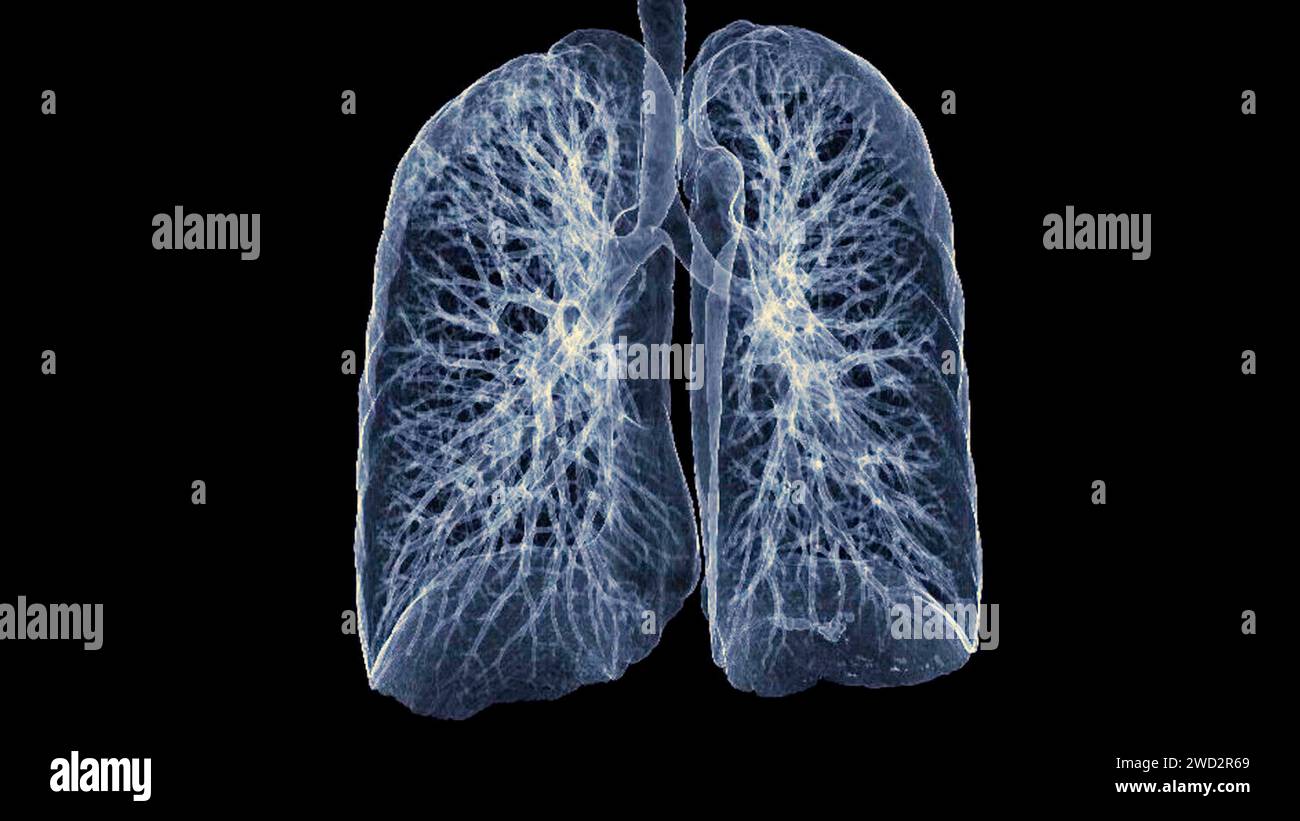 Immagine di rendering TC toracica o polmonare 3d che mostra trachea e polmoni nel sistema respiratorio. Foto Stock