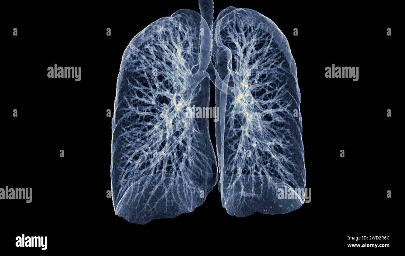 Immagine di rendering TC toracica o polmonare 3d che mostra trachea e polmoni nel sistema respiratorio. Foto Stock