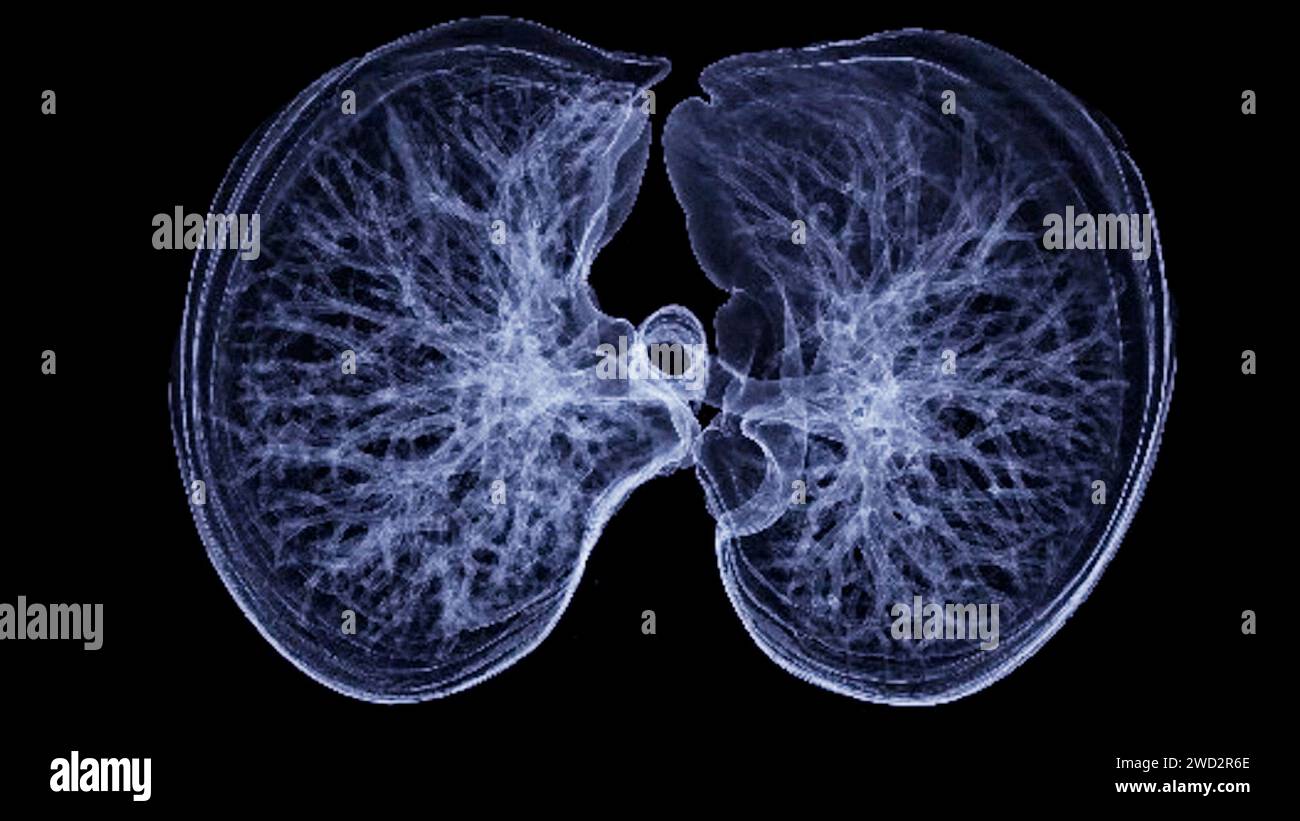 Immagine di rendering TC toracica o polmonare 3d che mostra trachea e polmoni nel sistema respiratorio. Foto Stock