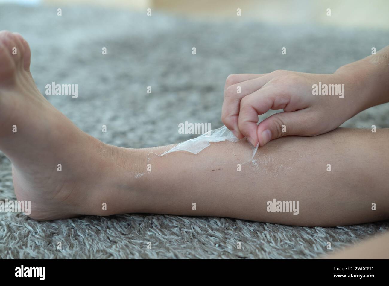 Le mani del bambino asiatico si staccano dalla pelle secca sulle gambe. Problemi alla pelle. Foto Stock