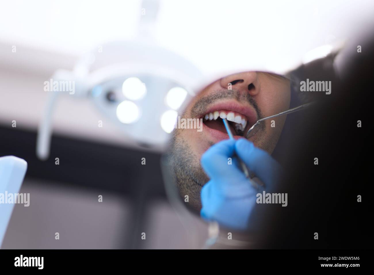 Un paziente esamina il suo sorriso in uno specchio durante un controllo dentale, mostrando una visione ravvicinata e personale delle cure odontoiatriche moderne Foto Stock