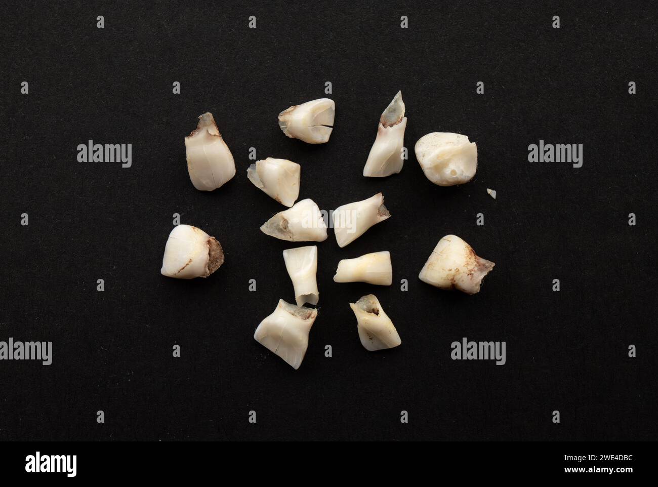 Raccolta di denti decidui, noti anche come denti del bambino, latte, primi o primi denti. Sfondo nero. Foto Stock