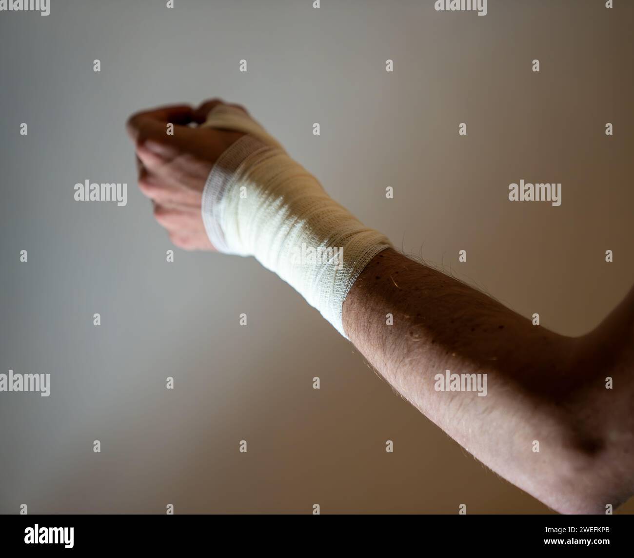 Lesione della mano sinistra maschile con benda Foto Stock