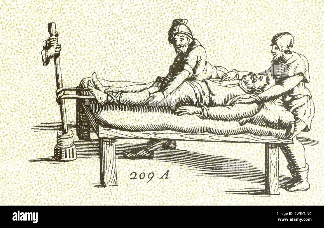Andrea Pralard ernia del disco lombare trattamento medievale. Foto Stock