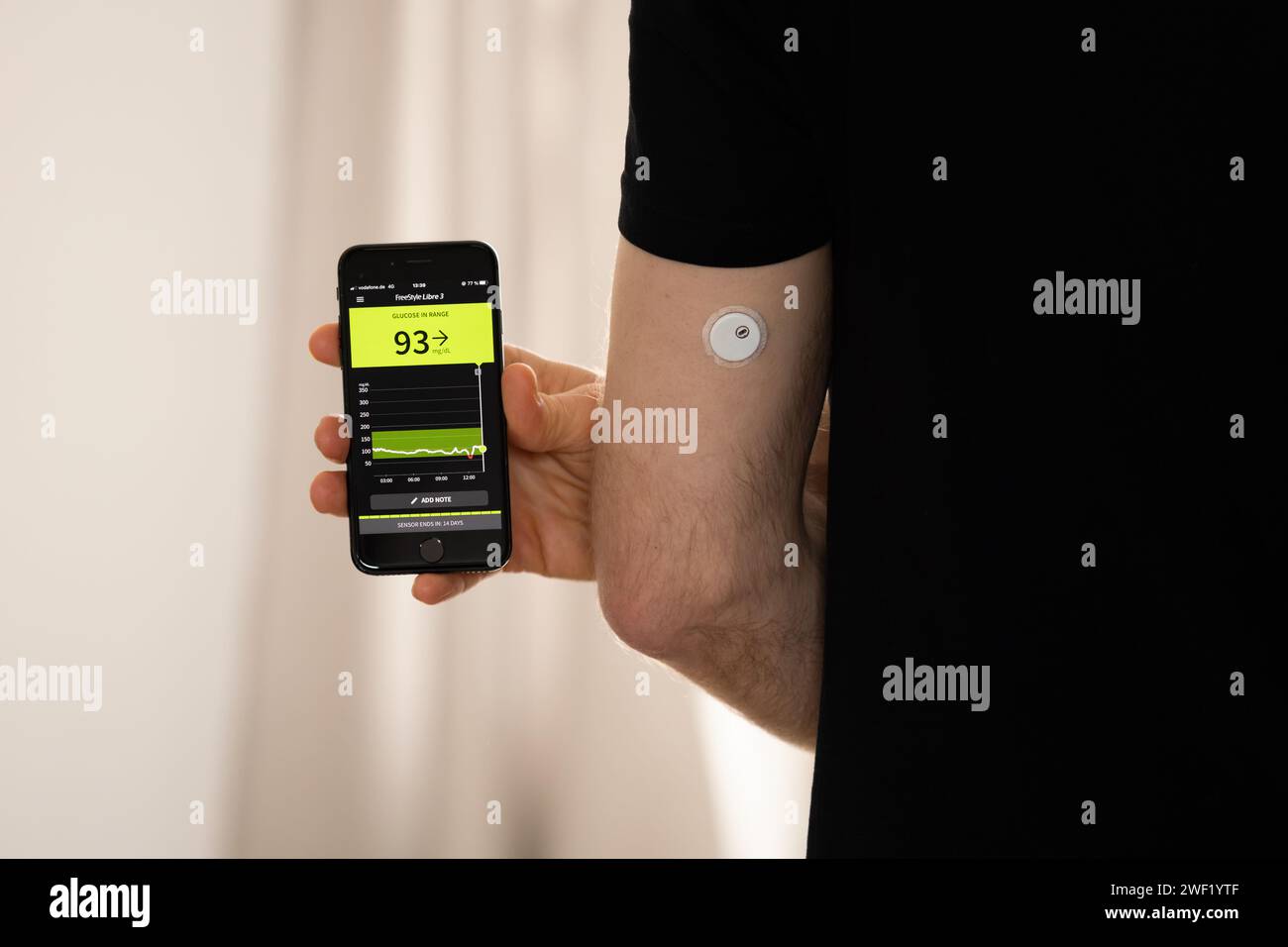 Sensore Freestyle Libre 3 e app sullo smartphone. Il dispositivo CGM misura il glucosio nel tessuto e invia i dati all'app digitale per la salute. Foto Stock